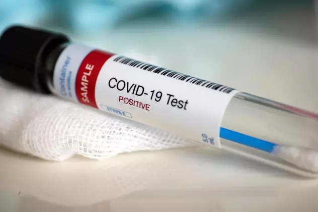 Tipuri de teste pentru depistarea infecției cu COVID. Cum alegi produsul potrivit?