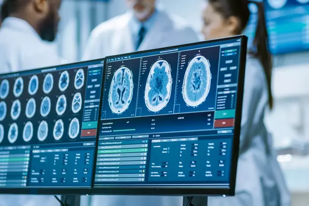 Care este diferenţa dintre Computer Tomograf (CT) și RMN - Imagine cu doi medici şi cu rezultatele unor investigaţii afişate pe mai multe monitoare