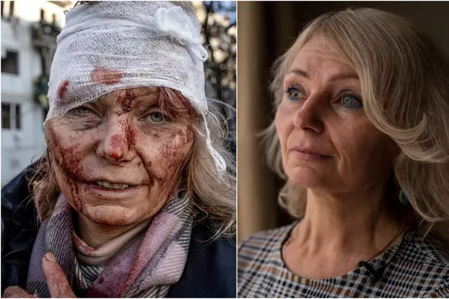 EXCLUSIV la un an de război. Femeia-simbol, rănită într-un bloc de locuințe în primul bombardament rusesc, interviu pentru români: „Încă mă tratez. Visez bombe, rachete, explozii”