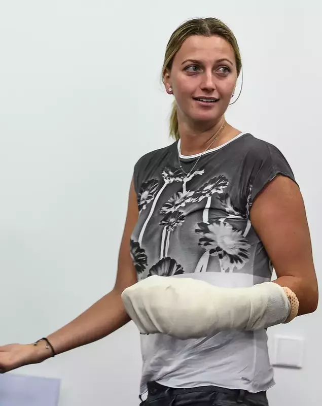 Two times Wimbledon winner Kvitova press conference after knife attack