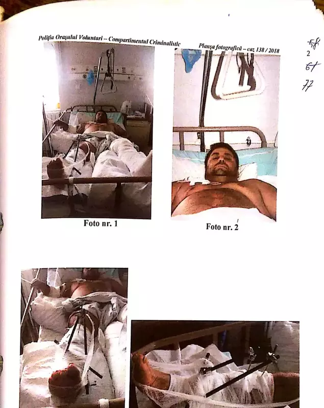 Imagini cu Berindei Marian zis Bucșă din spital