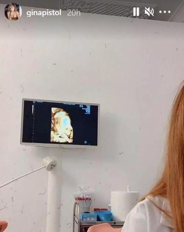 Gina-Pistol-ecografie-8