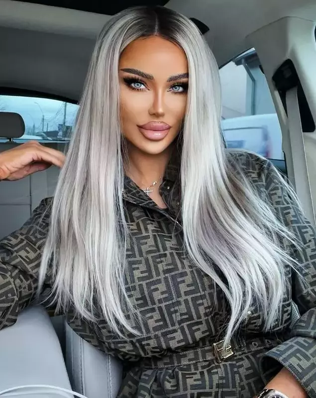 Bianca Drăgușanu operații estetice (1)