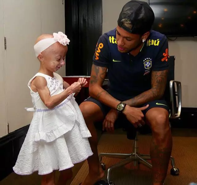 Neymar copil sindrom