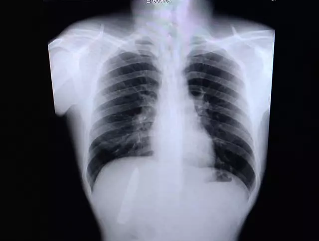 profimedia-0600944403