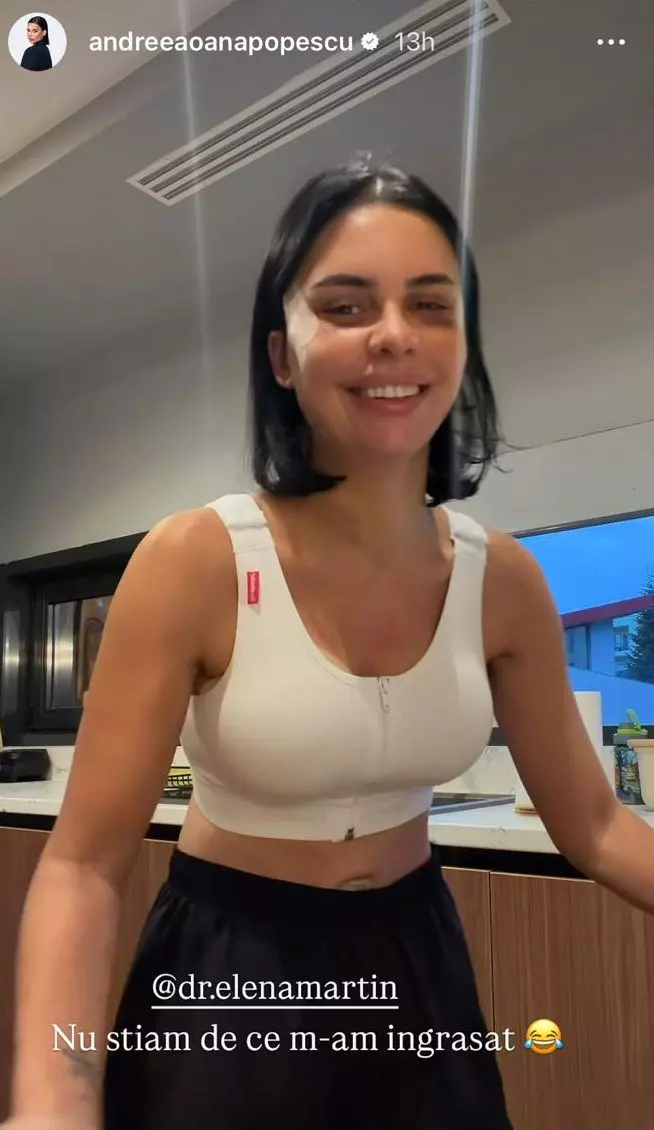 Andreea Popescu dupa operatiile estetice (8)