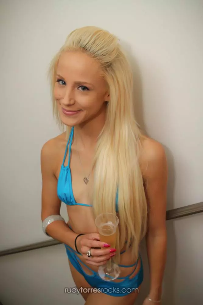 Suicide Burns Survivor ***EXCLUSIVE***