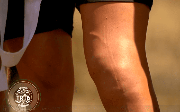 Dorian Popa - picior umflat - Ultimul Trib