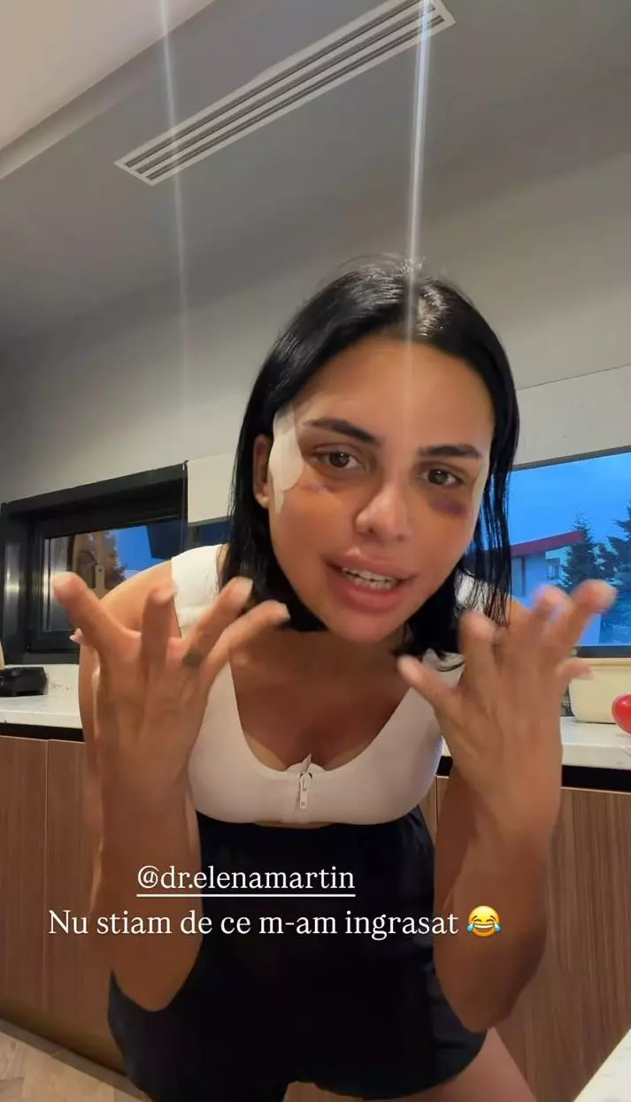 Andreea Popescu dupa operatiile estetice (10)