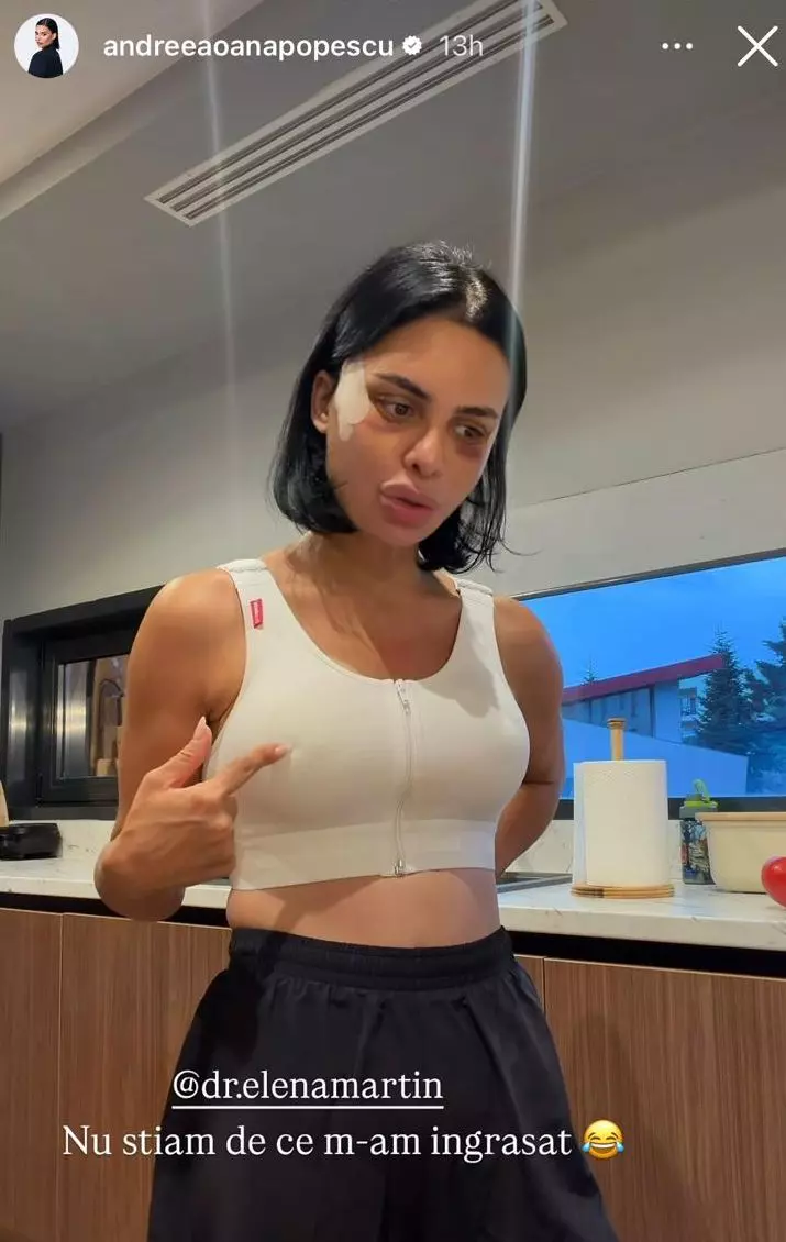 Andreea Popescu dupa operatiile estetice (7)