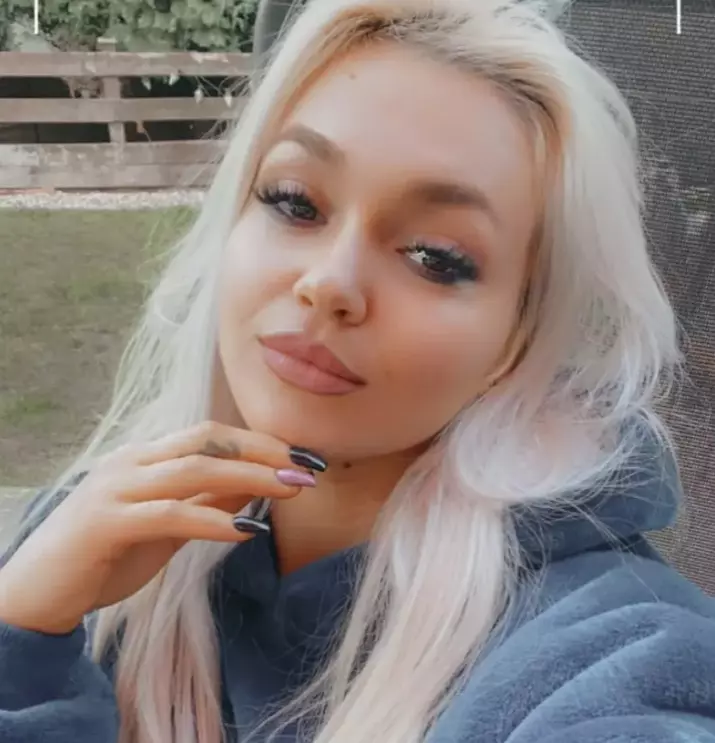 ella visan inainte de operatiile estetice 3
