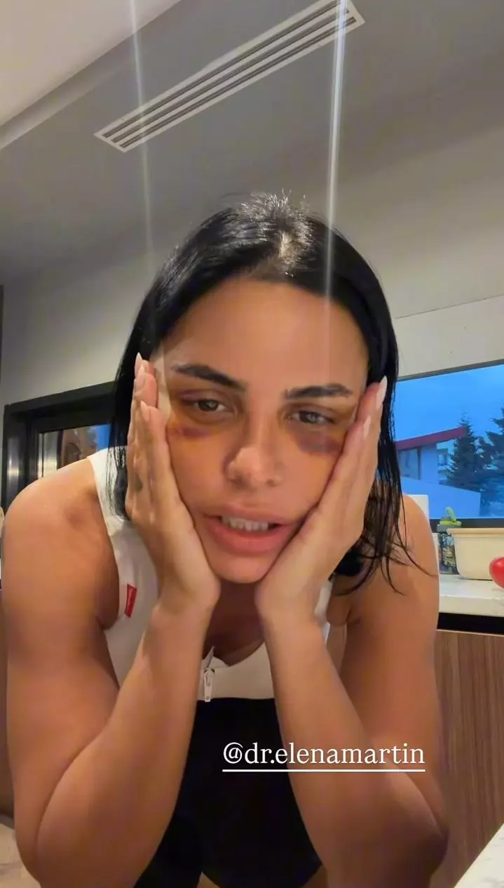 Andreea Popescu dupa operatiile estetice (9)