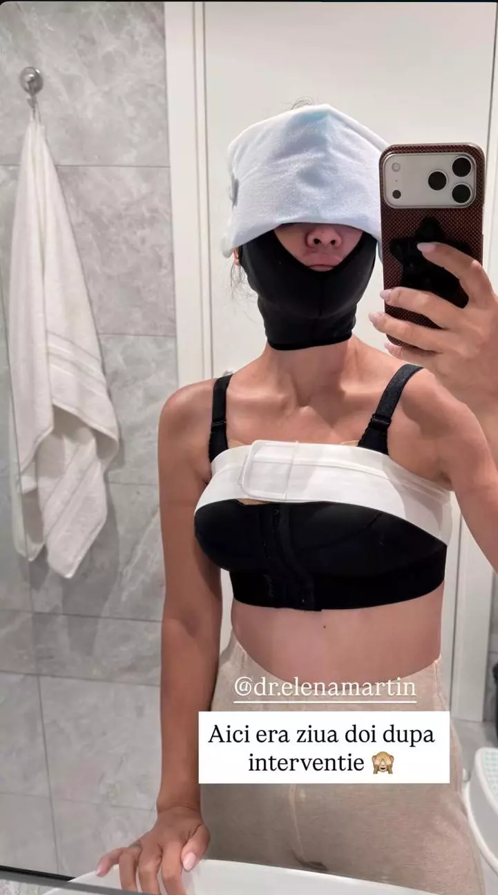 Andreea Popescu dupa operatiile estetice (4)