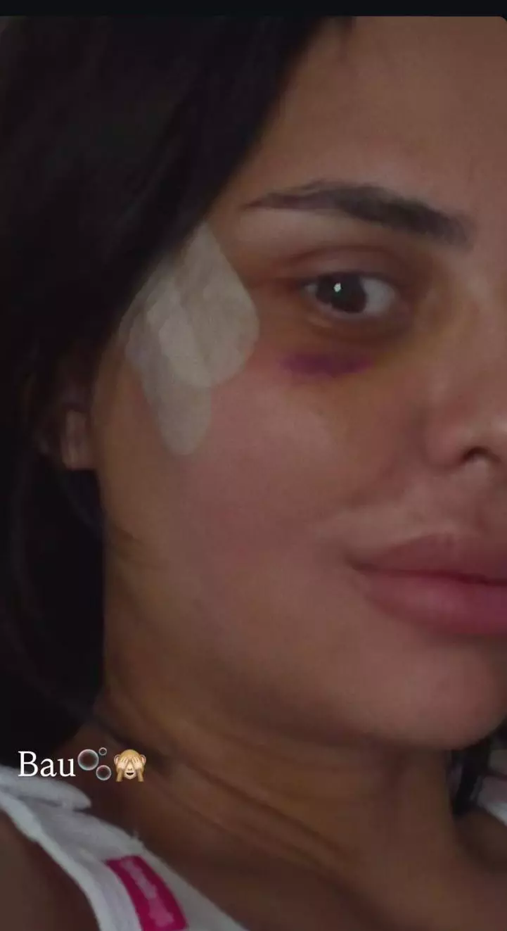 Andreea Popescu dupa operatiile estetice (2)