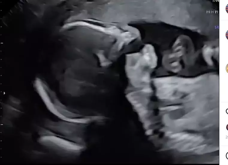 ecografie-bebelus-reghe