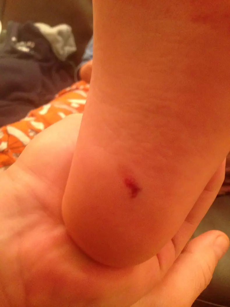 poze copil ranit sala joaca (5)