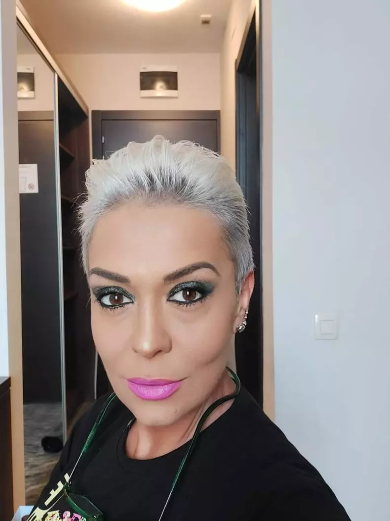 monica-anghel-interventii-estetice-la-fata-1
