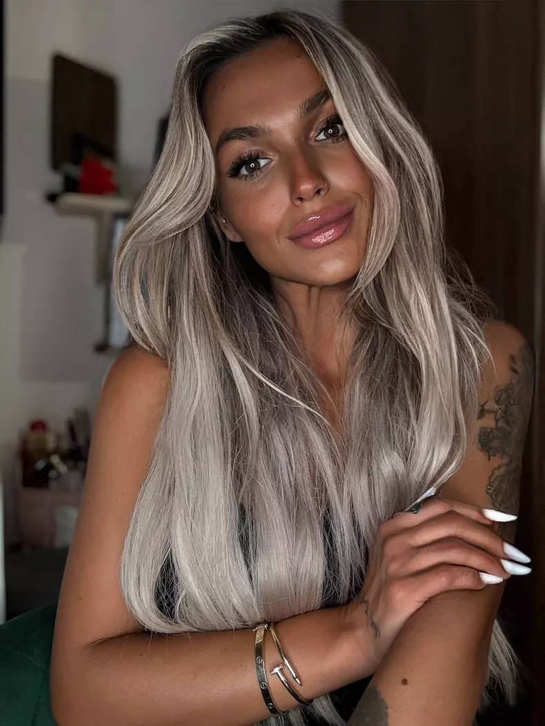 ella visan insula iubirii operatii estetice 3