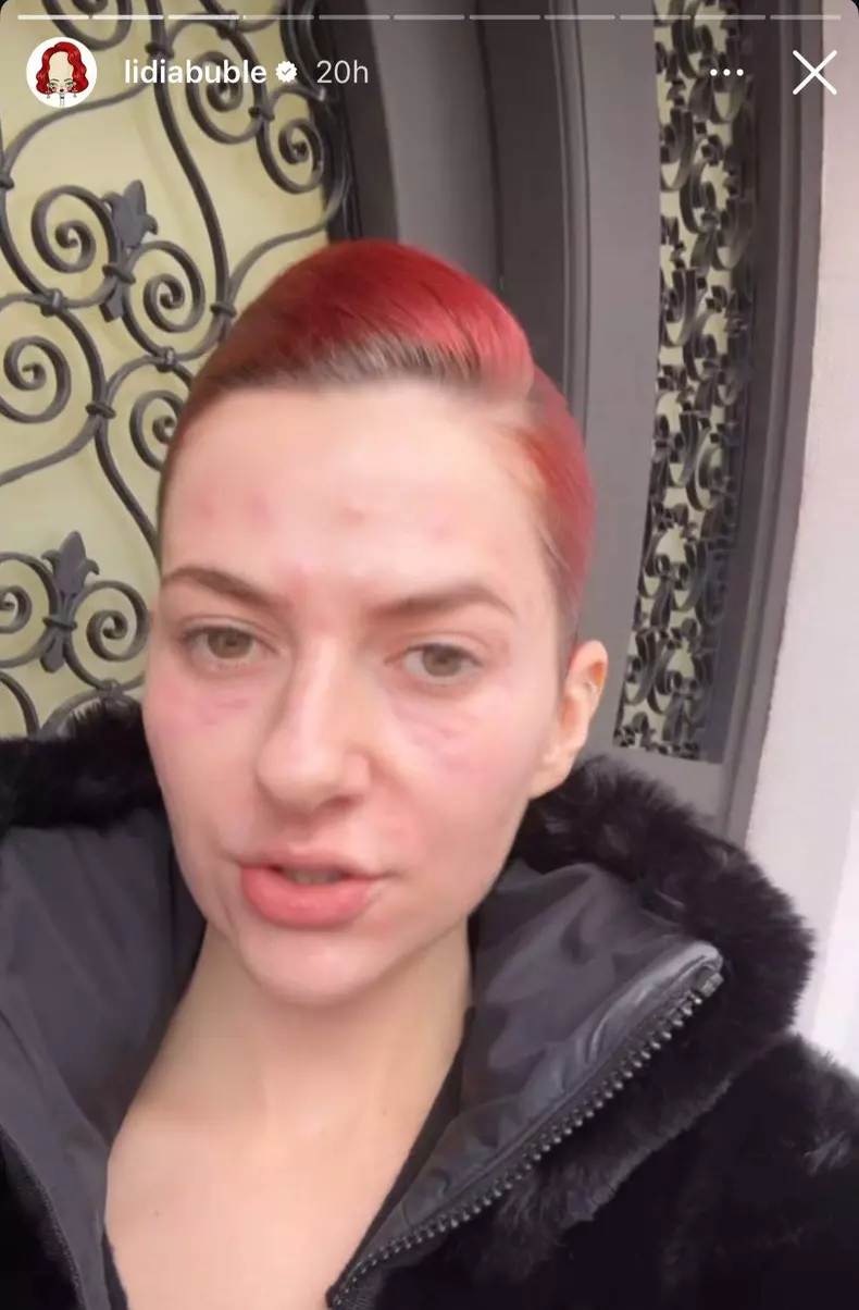 Lidia Buble nemachiata