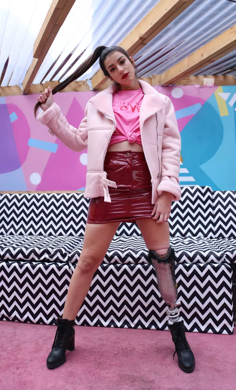 Un model din Italia și-a pierdut piciorul într-un accident