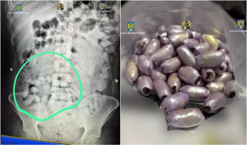 brazilian-cocaina-stomac-lipita-picioare-prins-otopeni