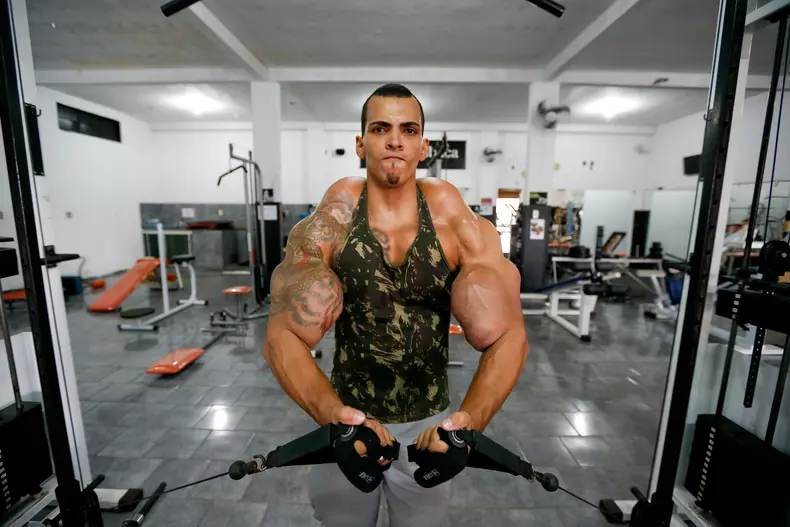 Muscle Injections Almost Cost This Man His Arms