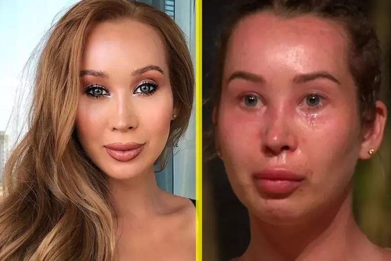 de-ce-a-aparut-xonia-cu-ftta-umflata-la-survivor-2022--ce-problema-a-avut-in-dominicana