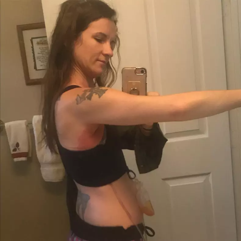 Toxic Breast Implants ***EXCLUSIVE***