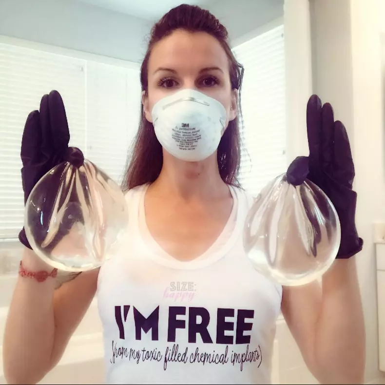 Toxic Breast Implants ***EXCLUSIVE***