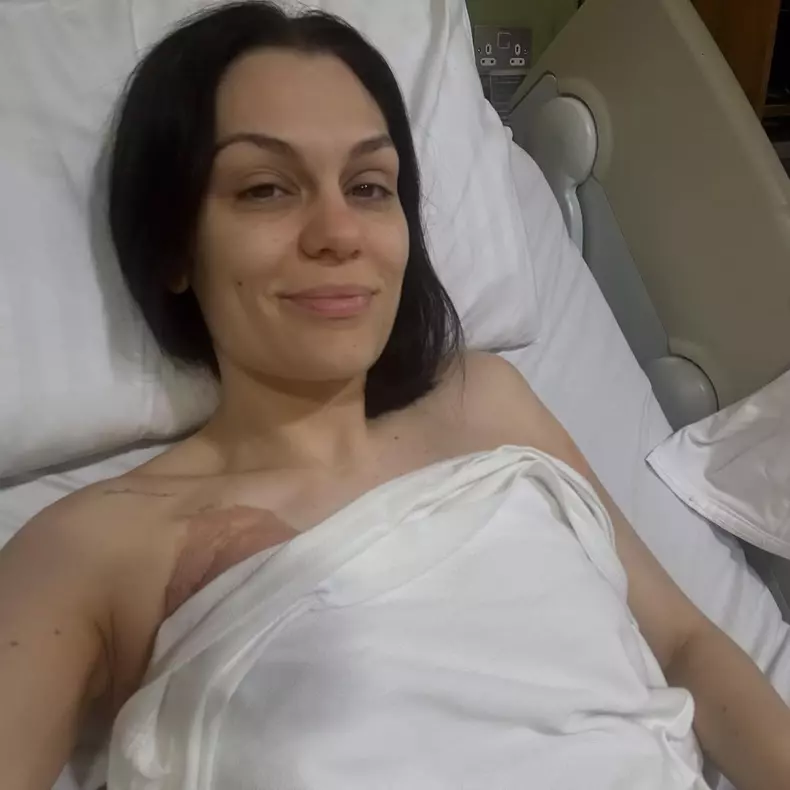 Jessie J a fost operată de cancer la sân (1)