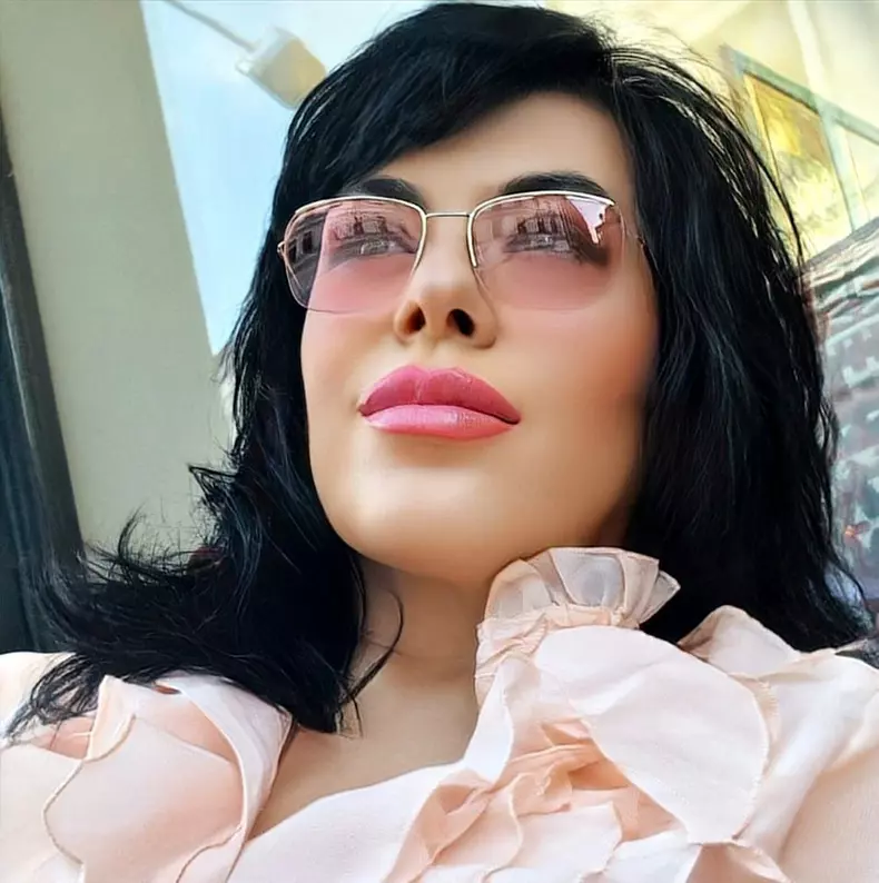 mariana-moculescu-interventie-estetica-2