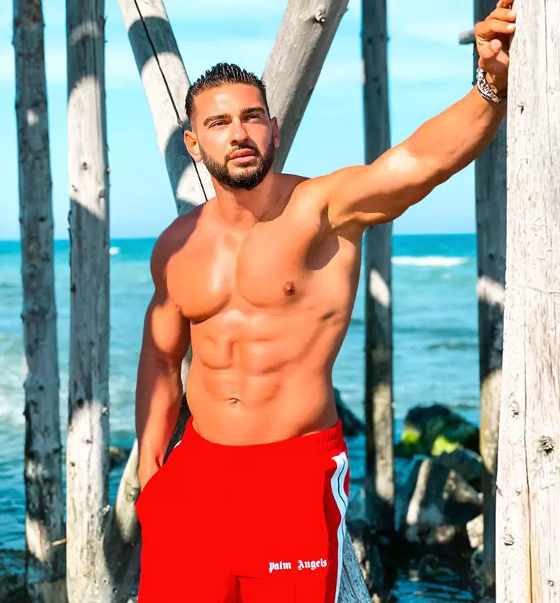 dorian-popa-operatie-estetica-2