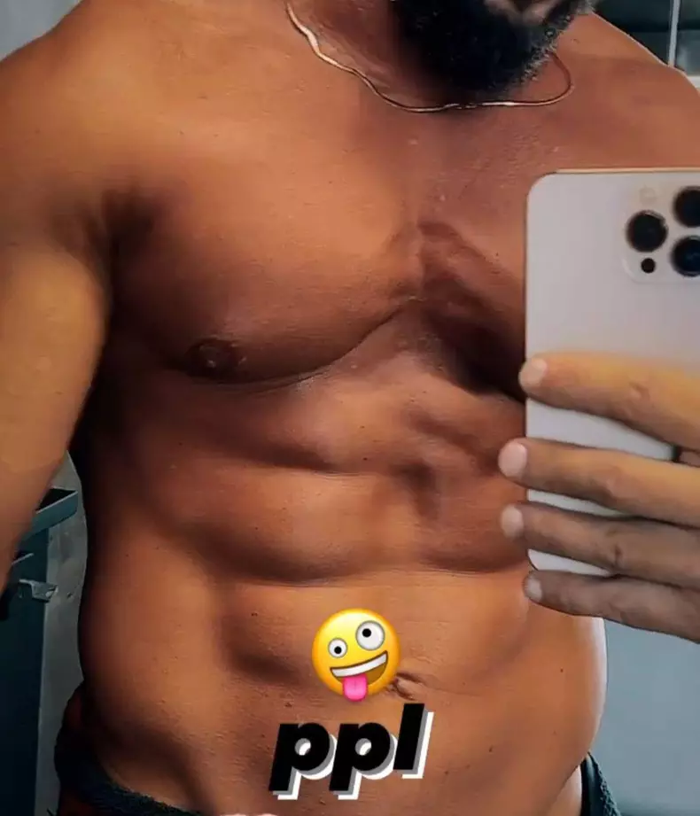 dorian-popa-interventie-estetica