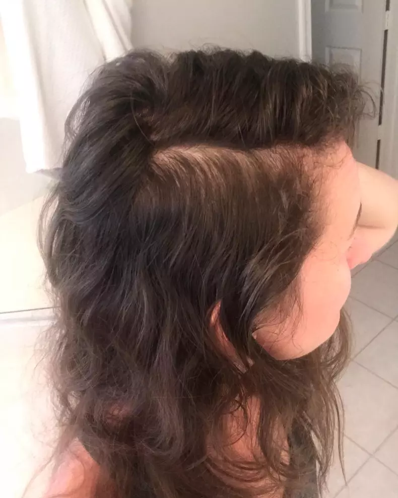 Toxic Breast Implants ***EXCLUSIVE***