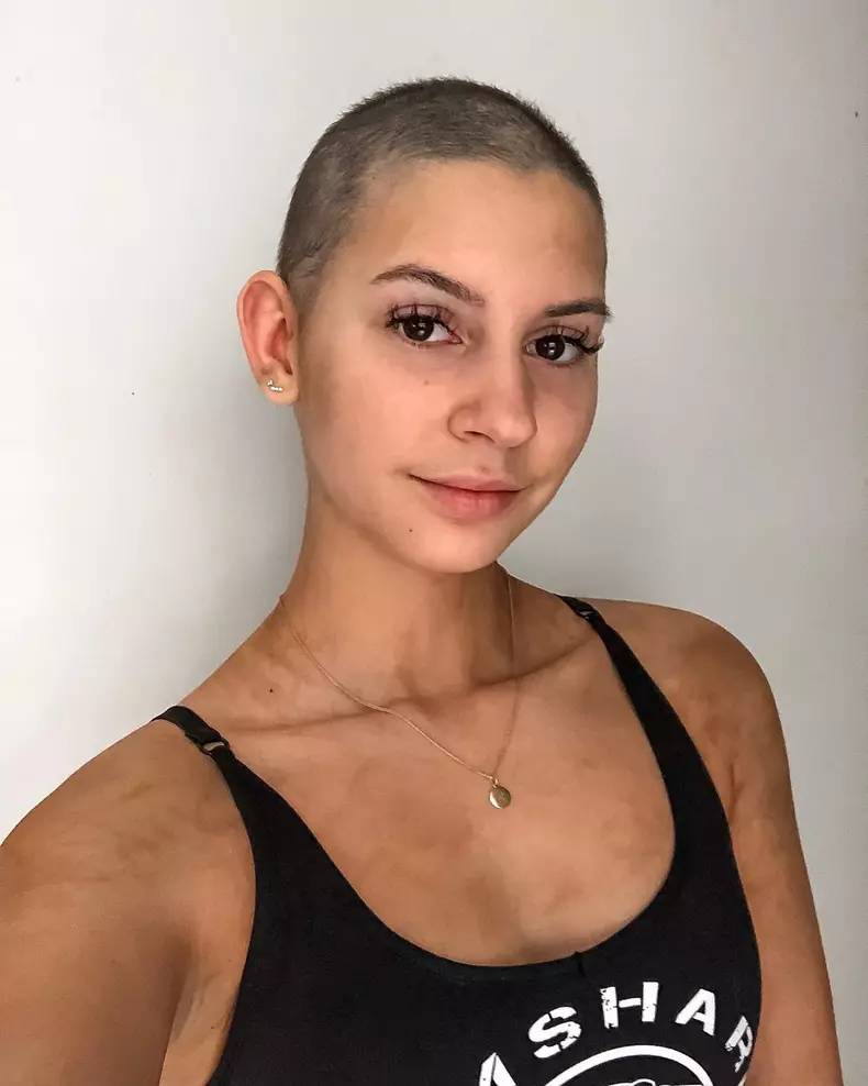 tk3s_mdrum_cancer_mistaken_for_an_sti-1