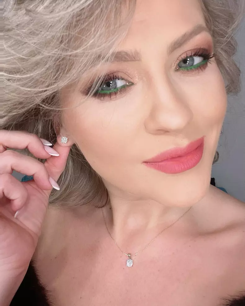 mirela-vaida-operatii-estetice-1