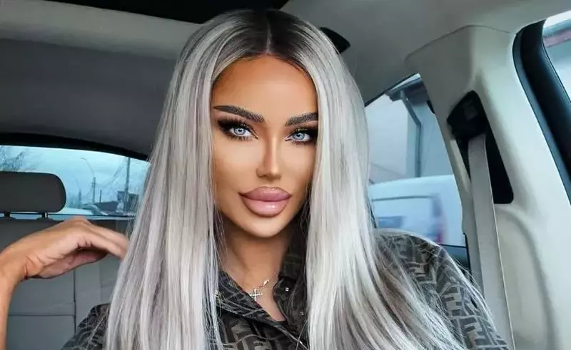 VIDEO Bianca Drăgușanu și-a topit acidul hialuronic din buze: „Fața mea a fost stricată. M-am injectat vreo 20 de ani mult și prost”
