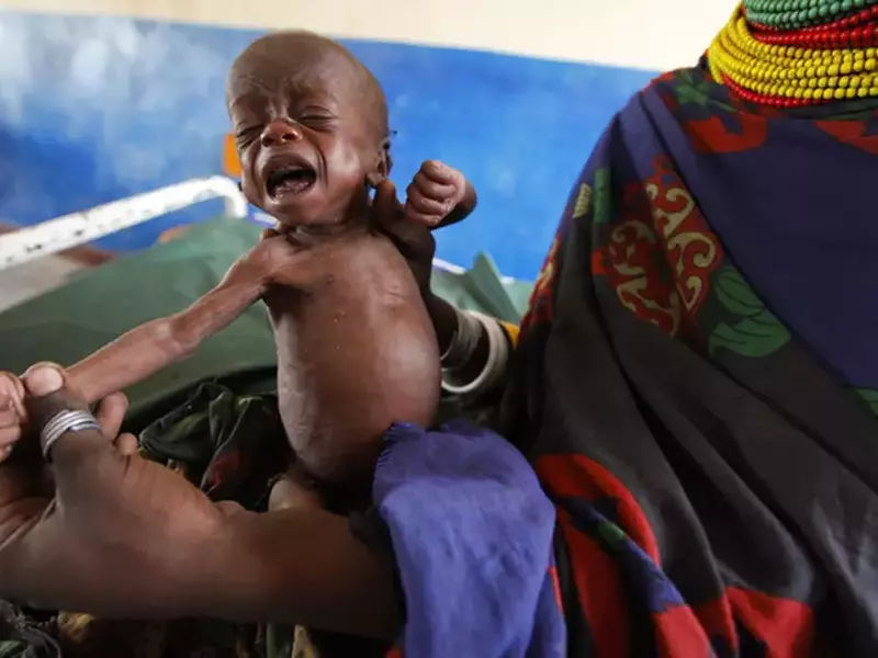 mame-somalia-copii-slabi-foame.jpg