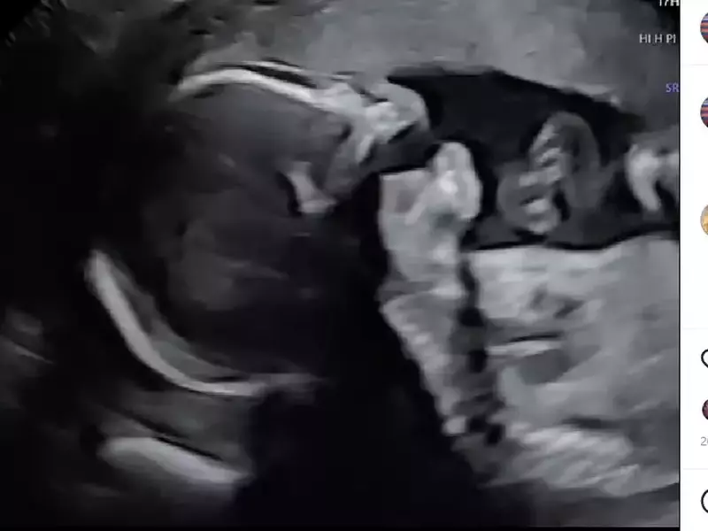 ecografie-bebelus-reghe