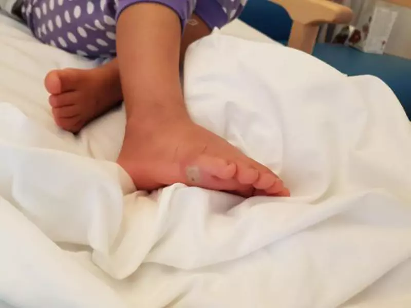 Piciorul rosu eritematos