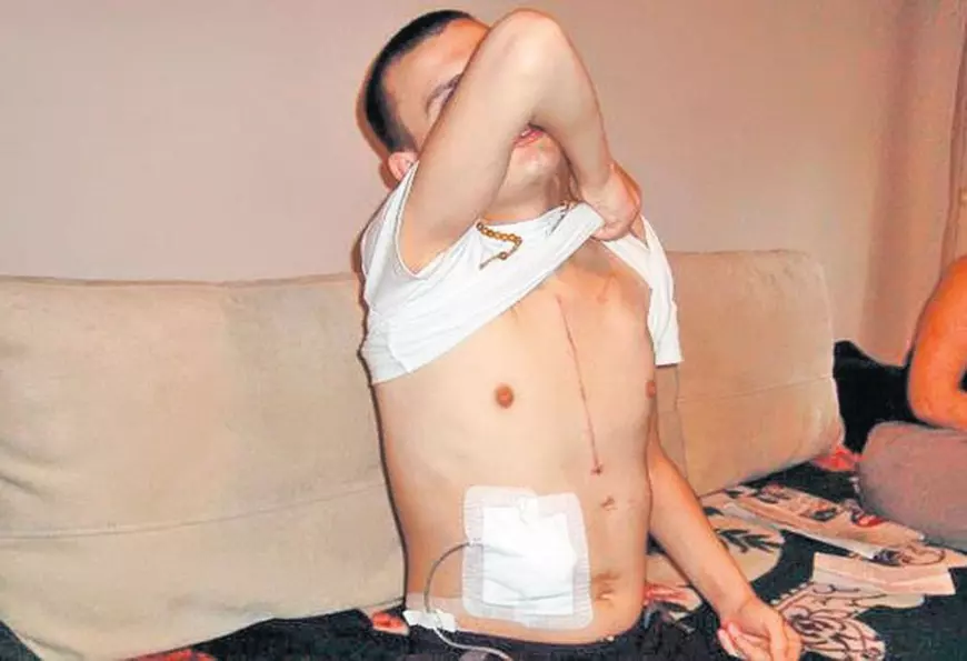 Tânărul povestește că era strigat “băiatul fără inimă” sau “băiatul cu inima în sac”