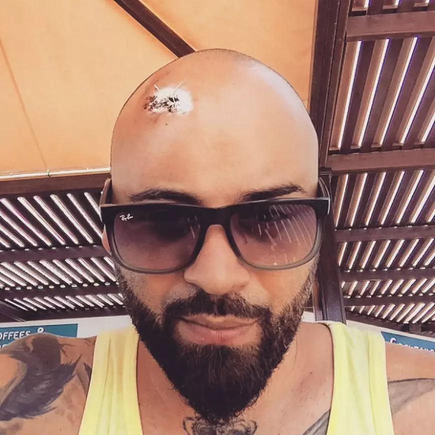 matteo-lovitura-la-cap