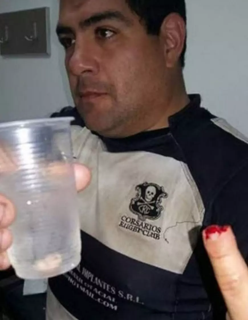 Daniel Contreras își arată degetul vătămat