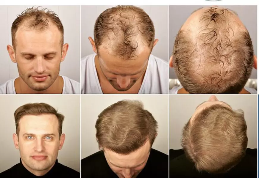 13923272_1739264429661905_4433380157903980474_o