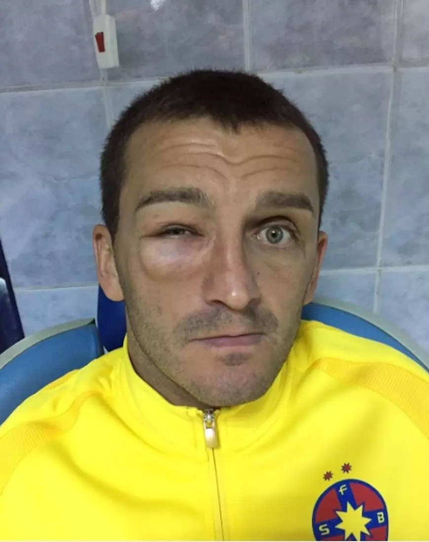 Bojan Golubovici e vătămat grav