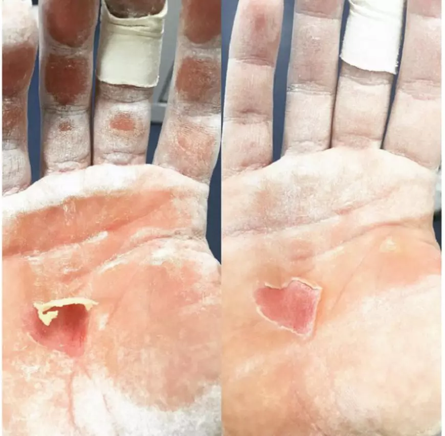 mainilecatalineiponor-620x608