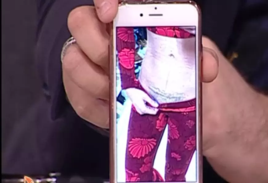 Bianca Drăgușanu și-a arătat operația de cezariană