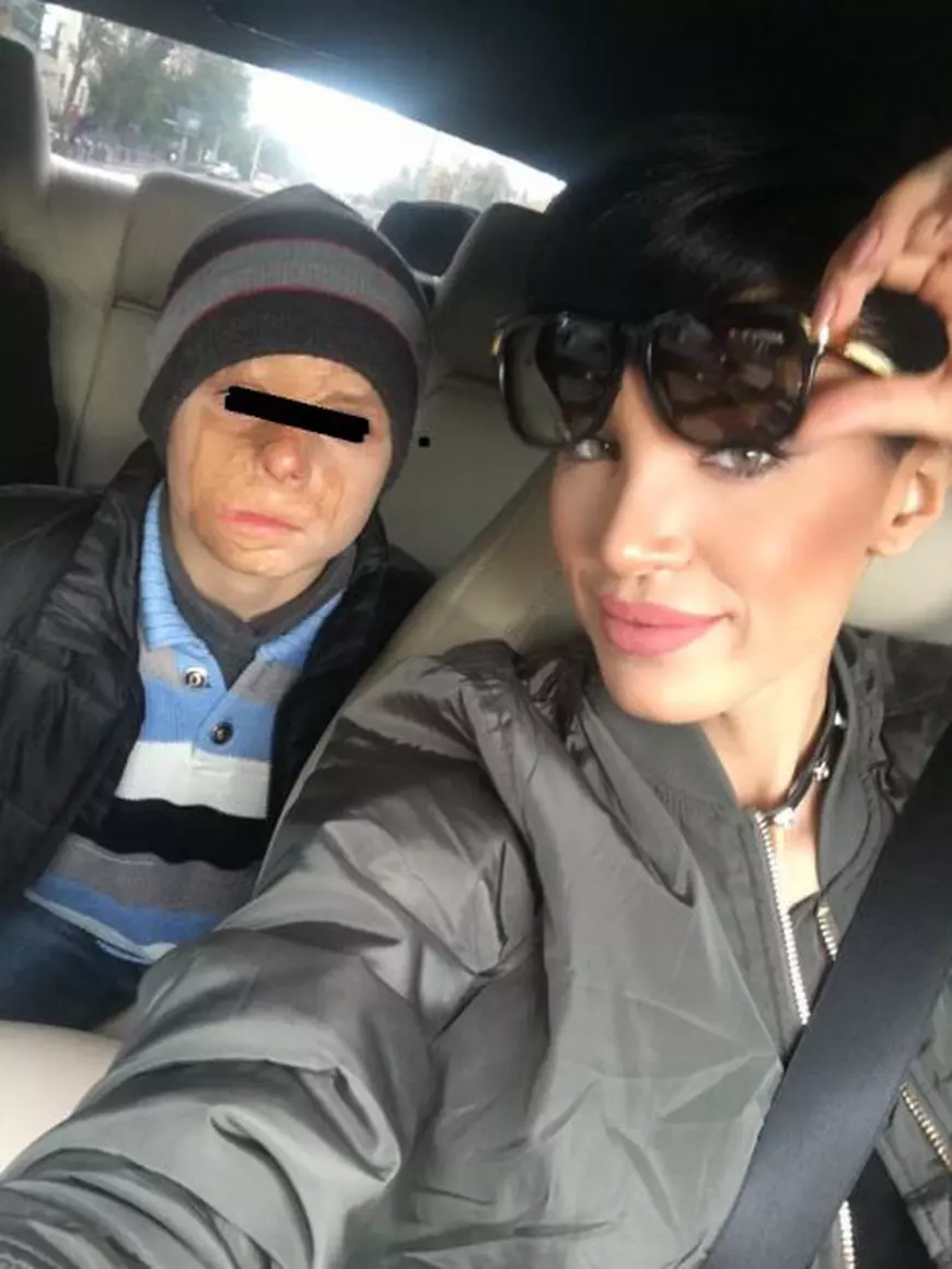 Adelina Pestrițu, înger păzitor pentru un băiețel cu fața arsă.