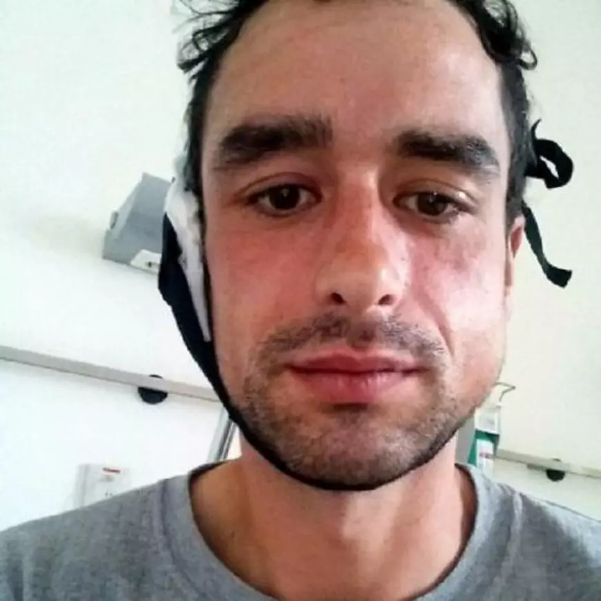 Alberto Mier Sanudo are urme vizibile în urma agresiunii