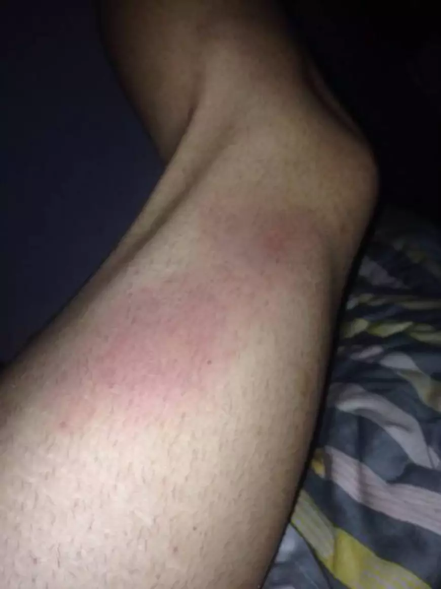 Așa arată mâna lui Dodoi!